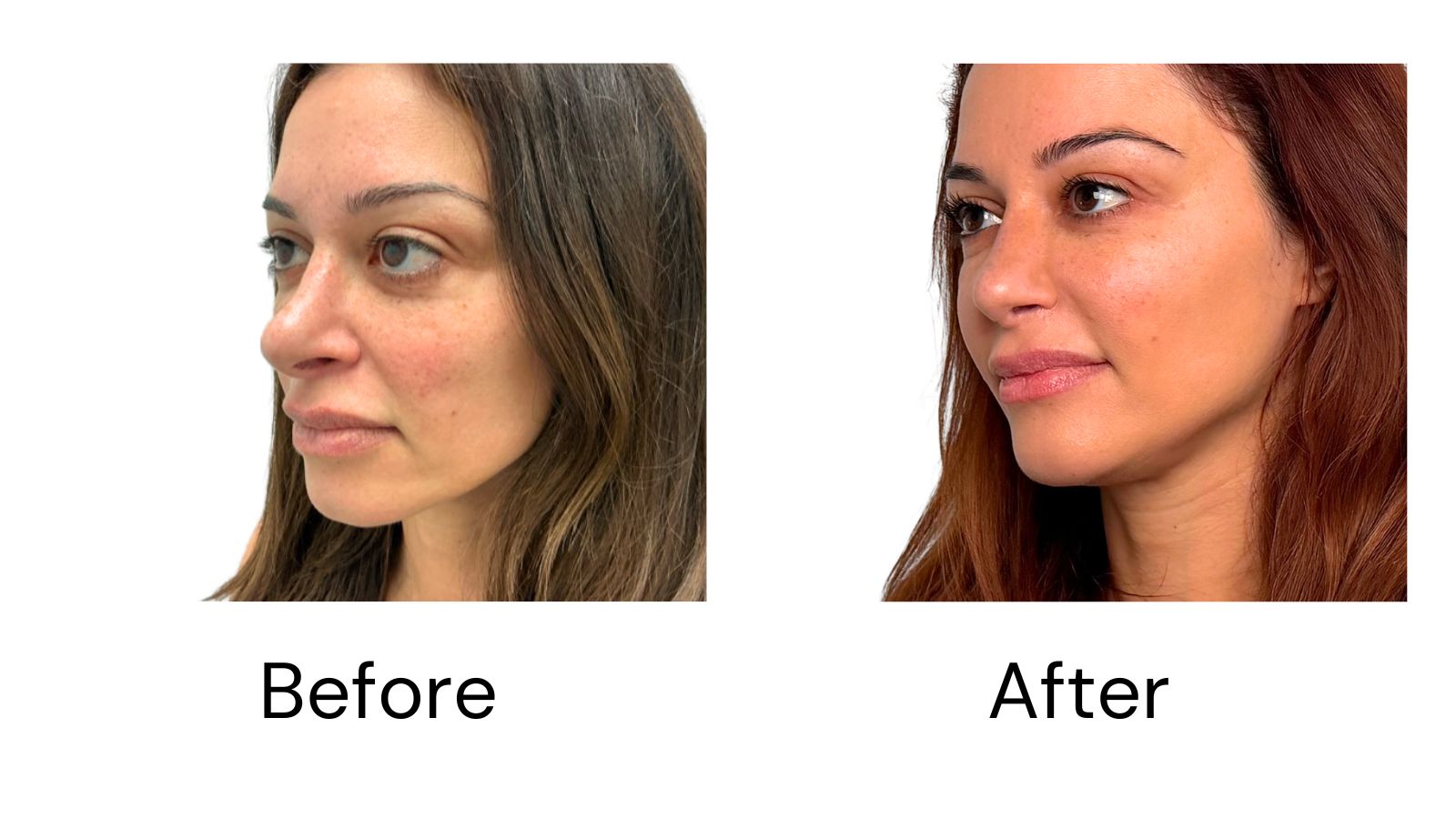 Client Results