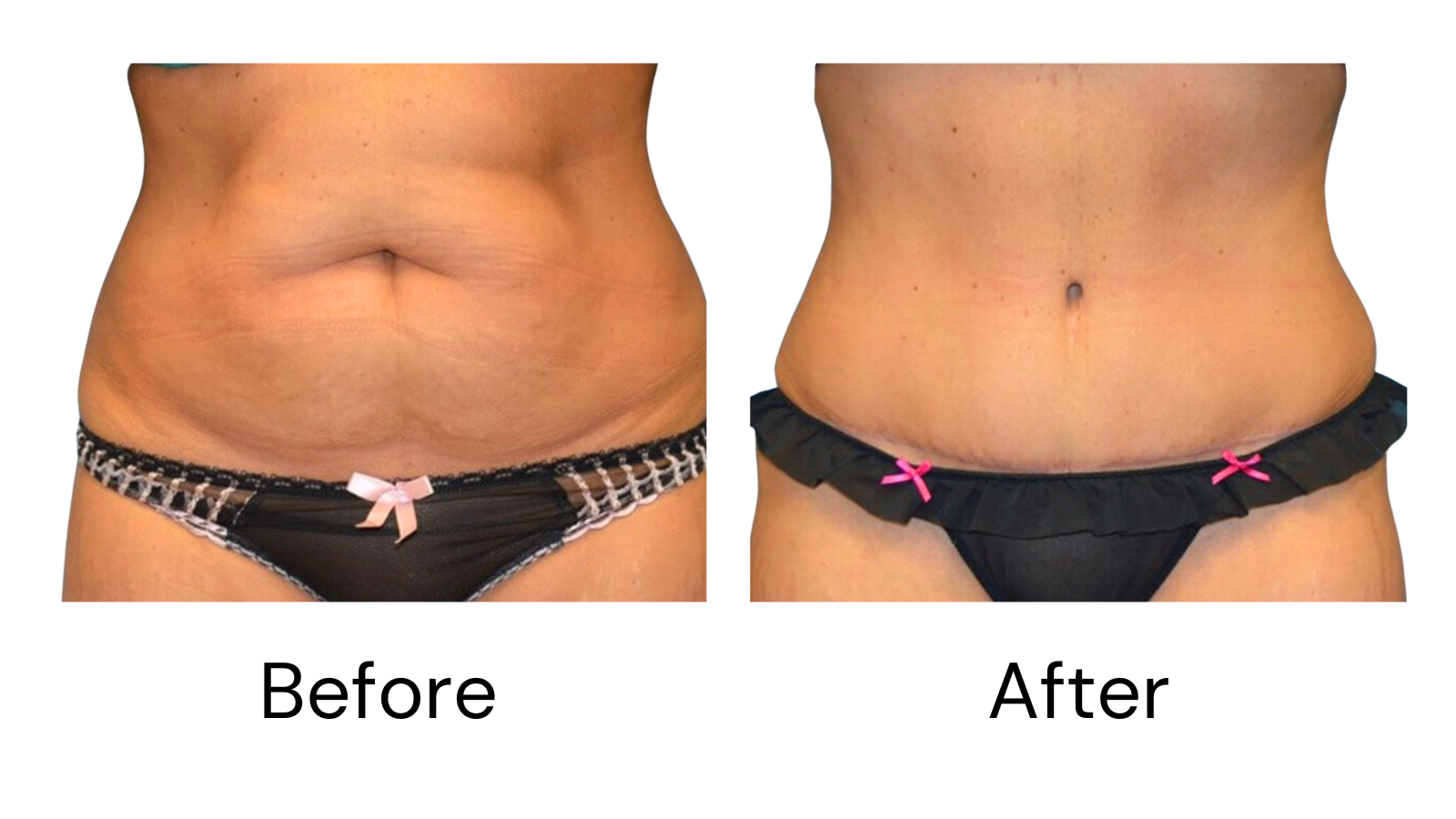 Client results
