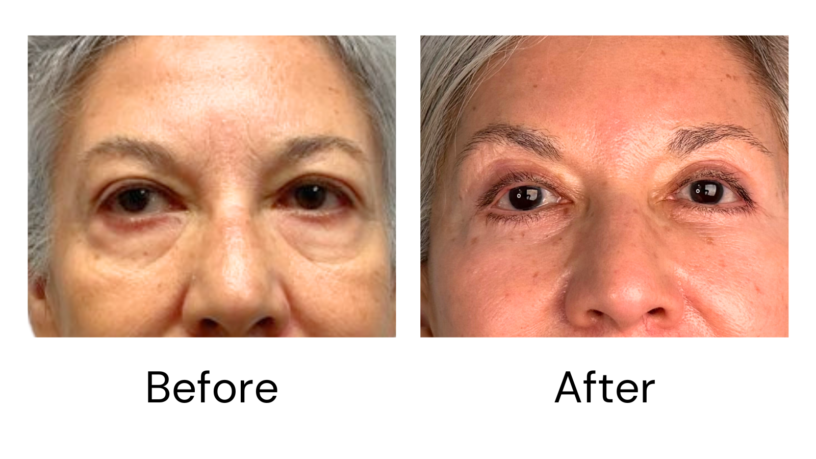 Client result
